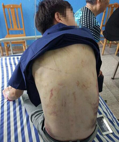 男子被骗缅甸赌钱 惨遭绑架虐待-澳门葡京赌场官网