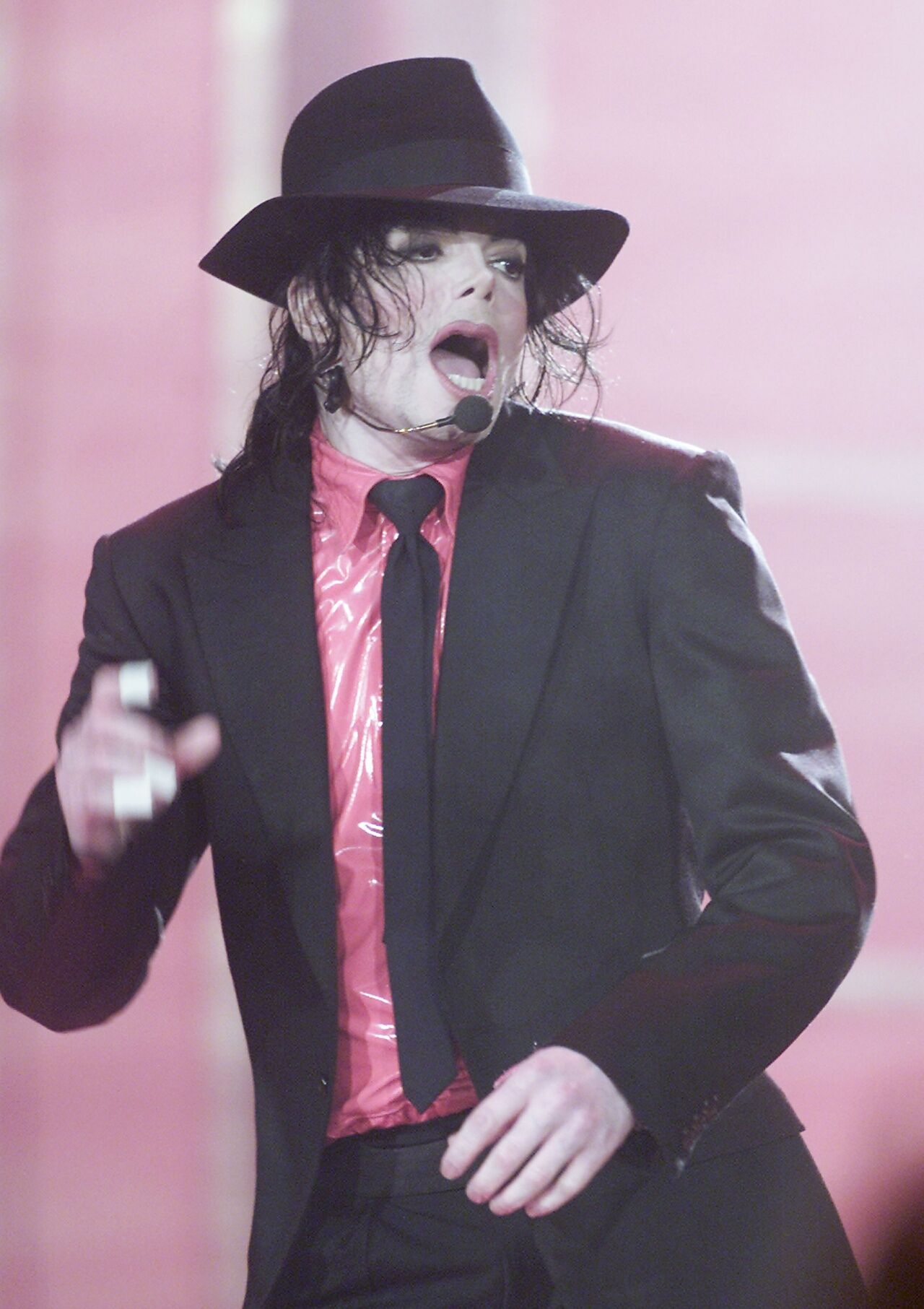 米高积逊受香港脚困扰